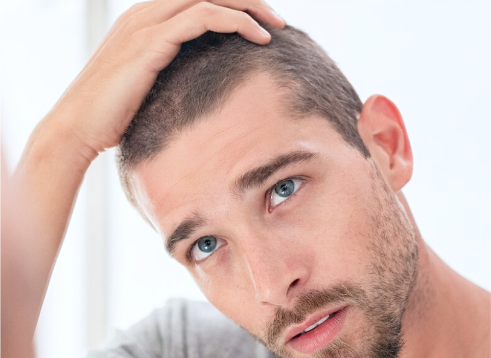Mesotherapy for Hair Loss Banner