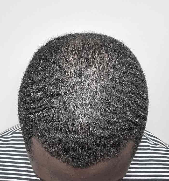 Male 35 after