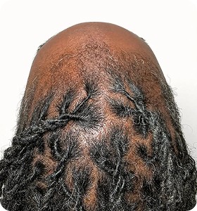 Female 43 before