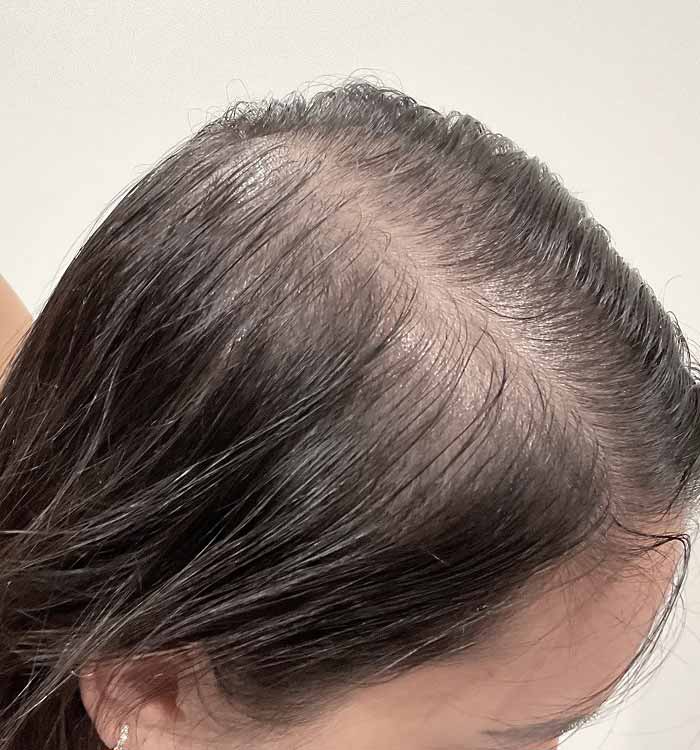 Female 32 before