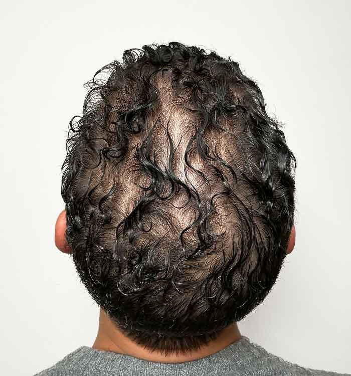Male 40 before