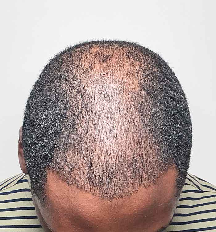 Male 35 before