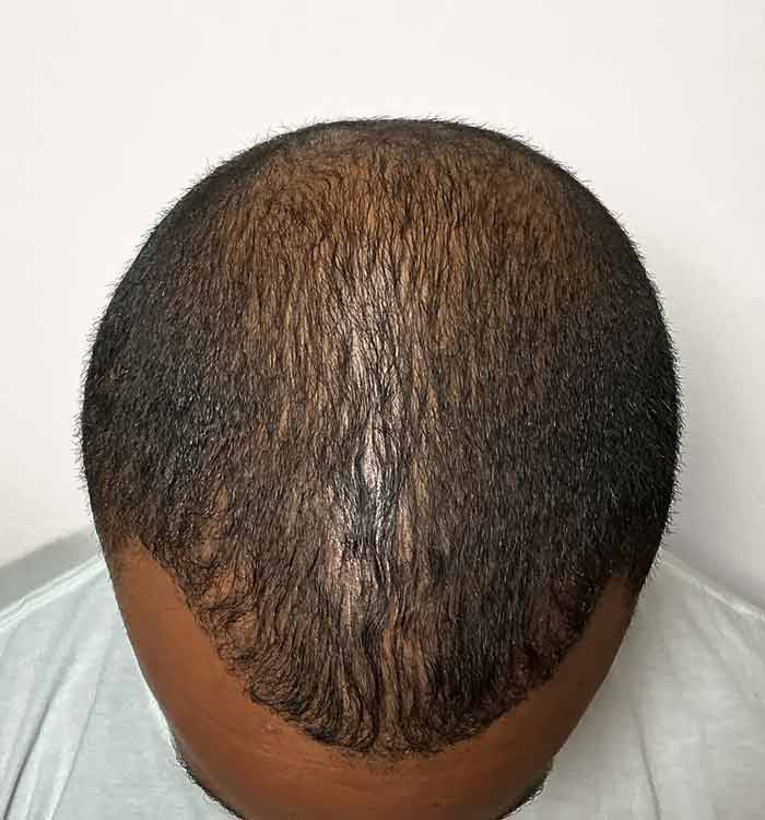 Male 38 after