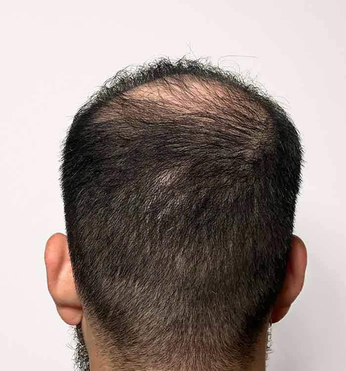 Male 37 after