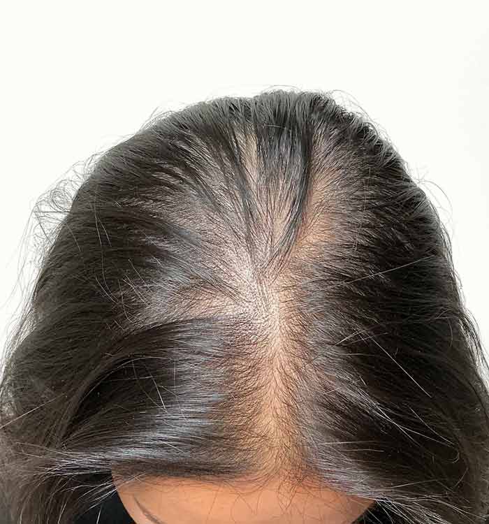 Female 37 before