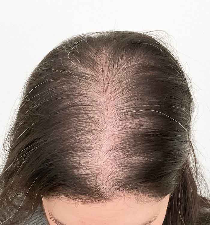 Female 49 before