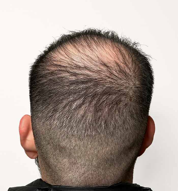 Male 37 before