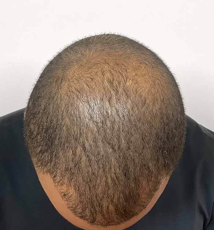 Male 38 before