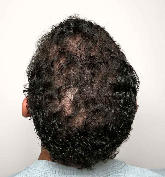 Male 40 after