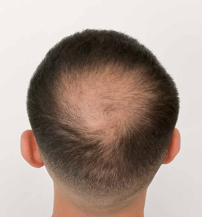 Male 31 before