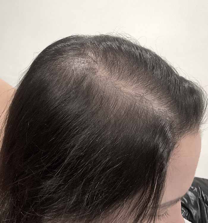 Female 32 after
