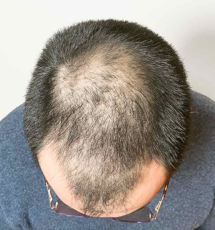 Male 30 before