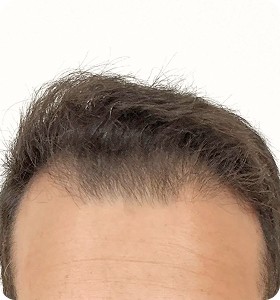 Male 29 before